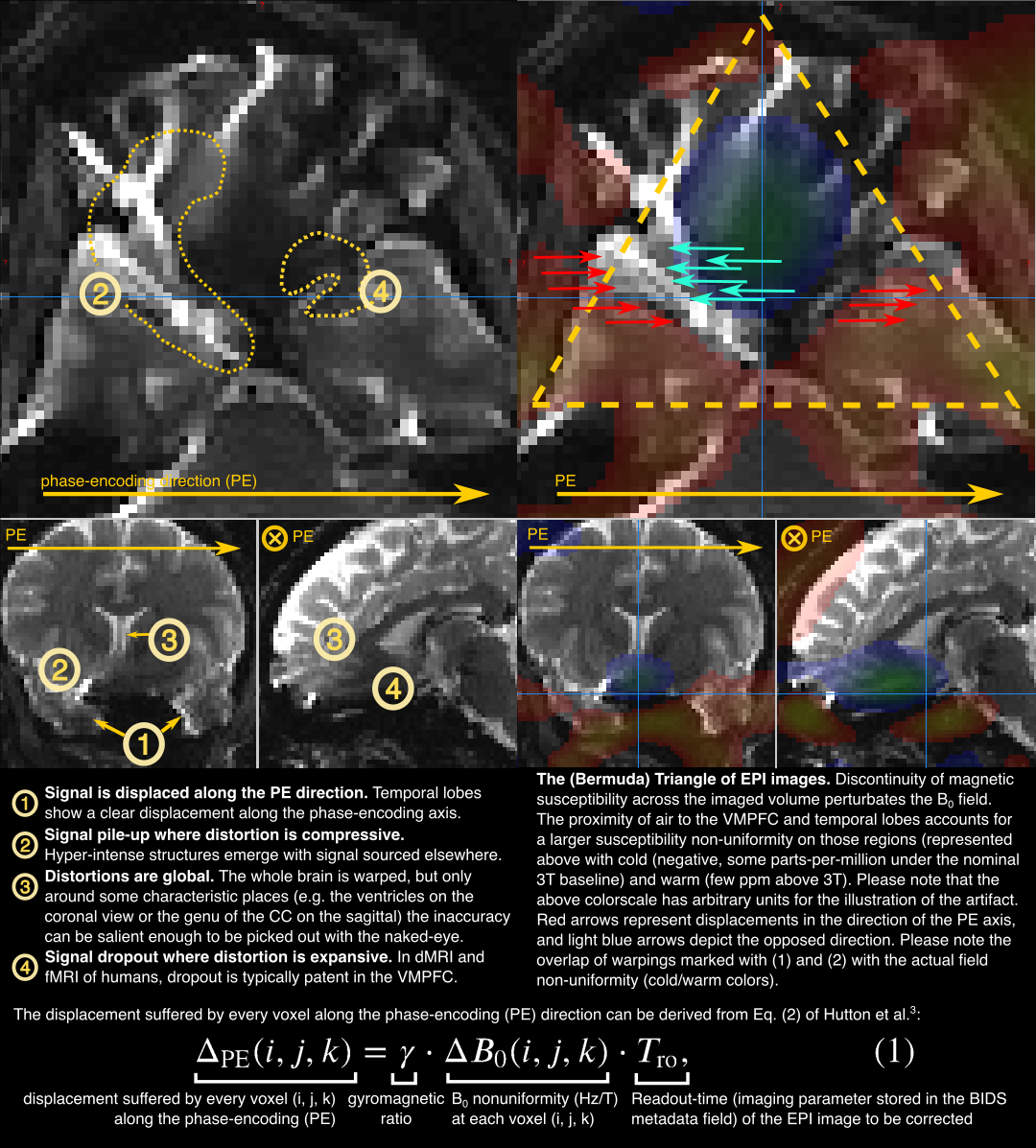 _images/sdcflows-OHBM21-fig1.png