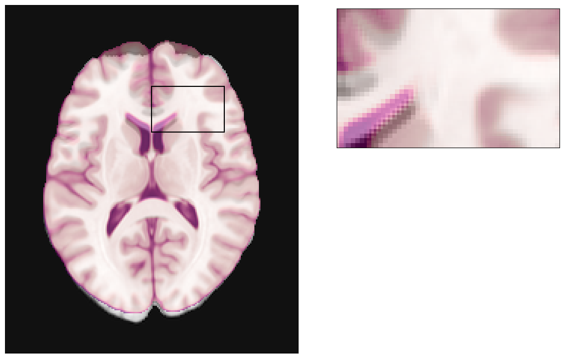 ../_images/notebooks_SDC_-_Theory_and_physics_34_0.png
