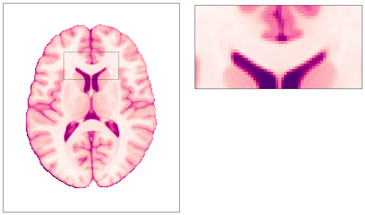 ../_images/notebooks_SDC_-_Theory_and_physics_9_0.png