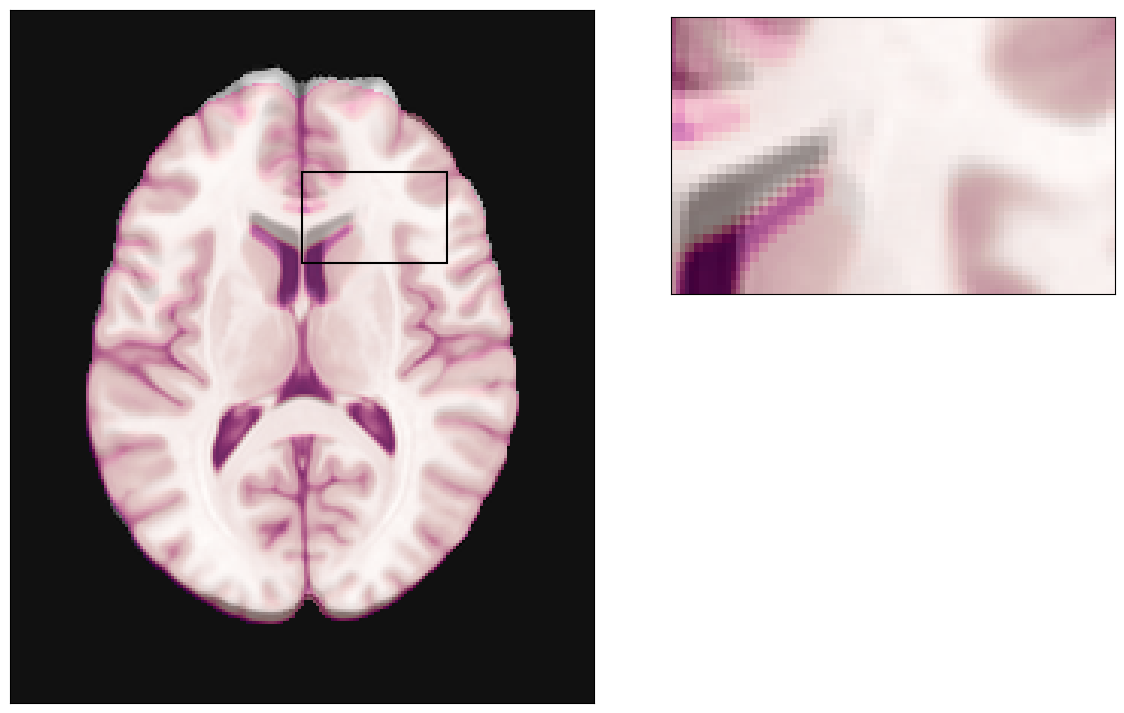 ../_images/notebooks_SDC_-_Theory_and_physics_32_0.png