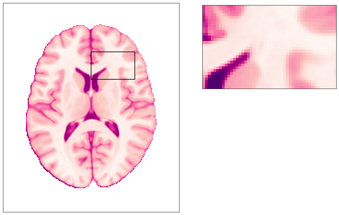 ../_images/notebooks_SDC_-_Theory_and_physics_9_0.png